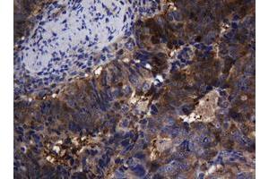 Image no. 4 for anti-TSC22 Domain Family, Member 1 (TSC22D1) antibody (ABIN1501537) (TSC22D1 anticorps)