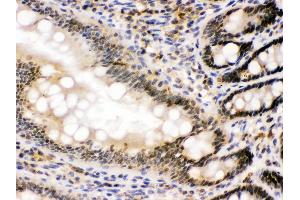 nmt55/p54nrb was detected in paraffin-embedded sections of rat intestine tissues using rabbit anti- nmt55/p54nrb Antigen Affinity purified polyclonal antibody at 1 μg/mL. (NONO anticorps  (N-Term))