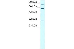WB Suggested Anti-SND1 Antibody Titration:  1. (SND1 anticorps  (N-Term))