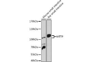Western blot analysis of extracts of various cell lines, using MTTP antibody (ABIN6129583, ABIN6144184, ABIN6144185 and ABIN6218239) at 1:1000 dilution. (MTTP anticorps  (AA 1-130))