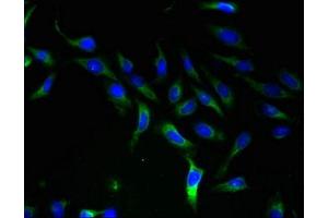 Immunofluorescent analysis of Hela cells using ABIN7170199 at dilution of 1:100 and Alexa Fluor 488-congugated AffiniPure Goat Anti-Rabbit IgG(H+L)