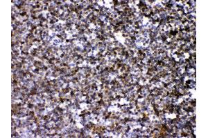 ARHGEF1 was detected in paraffin-embedded sections of mouse lymphaden tissues using rabbit anti- ARHGEF1 Antigen Affinity purified polyclonal antibody (Catalog # ) at 1 ?