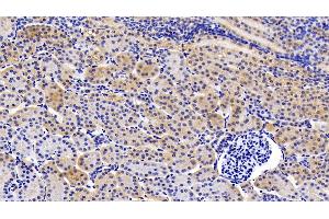 Detection of gp130 in Porcine Kidney Tissue using Polyclonal Antibody to Glycoprotein 130 (gp130) (CD130/gp130 anticorps  (AA 392-566))