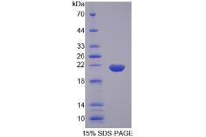 SDS-PAGE analysis of Human CPLX1 Protein. (Complexin 1 Protein (CPLX1))