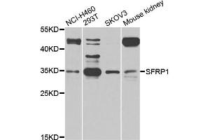 Western blot analysis of extracts of various cell lines, using SFRP1 antibody (ABIN5975810) at 1/1000 dilution. (SFRP1 anticorps)