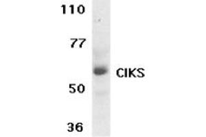 Image no. 1 for anti-TRAF3 Interacting Protein 2 (TRAF3IP2) (AA 554-568) antibody (ABIN205307) (TRAF3IP2 anticorps  (AA 554-568))