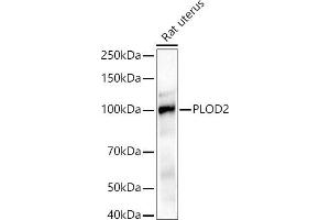 Western blot analysis of extracts of Rat uterus, using PLOD2/LH2 antibody (ABIN6132888, ABIN6145788, ABIN6145790 and ABIN6222693) at 1:1000 dilution. (PLOD2 anticorps  (AA 470-650))
