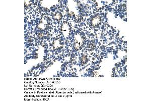 Rabbit Anti-PCBP2 Antibody  Paraffin Embedded Tissue: Human Lung Cellular Data: Alveolar cells Antibody Concentration: 4. (PCBP2 anticorps  (Middle Region))