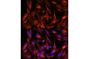 Immunofluorescence analysis of C6 cells using α-Tubulin Rabbit pAb (ABIN3020549, ABIN3020550 and ABIN3020551) at dilution of 1:100 (40x lens). (TUBA4A anticorps  (AA 1-180))