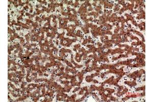 Immunohistochemistry (IHC) analysis of paraffin-embedded Human Liver, antibody was diluted at 1:100.