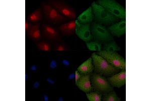ABIN6257593 and ABIN6274990 staining  cells by IF/ICC.