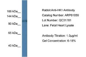 Western Blotting (WB) image for anti-Hexokinase 1 (HK1) (N-Term) antibody (ABIN2788663) (Hexokinase 1 anticorps  (N-Term))