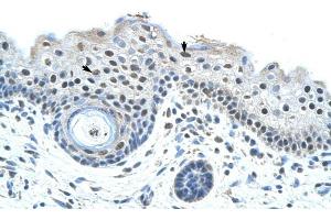 SF3B1 antibody was used for immunohistochemistry at a concentration of 4-8 ug/ml to stain Epidermal cells (arrows) in Human Skin.
