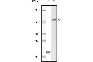 Western Blotting (WB) image for anti-Lymphocyte-Specific Protein tyrosine Kinase (LCK) (truncated) antibody (ABIN2464076) (LCK anticorps  (truncated))
