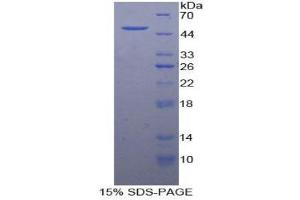 SDS-PAGE (SDS) image for Growth Arrest-Specific 6 (GAS6) (AA 59-221) protein (His tag,GST tag) (ABIN1879866)