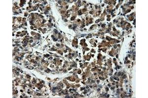 Image no. 2 for anti-Induced Myeloid Leukemia Cell Differentiation Protein Mcl-1 (MCL1) antibody (ABIN1499342)