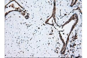 Immunohistochemical staining of paraffin-embedded Human prostate tissue using anti-TBXAS1 mouse monoclonal antibody. (TBXAS1 anticorps)
