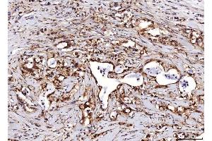 IHC analysis of ENO1 using anti-ENO1 antibody (ABIN7601902). (ENO1 anticorps  (AA 50-250))