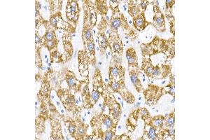 Immunohistochemistry of paraffin-embedded human liver using ACADS / SCAD Rabbit mAb (ABIN7265419) at dilution of 1:50 (40x lens). (ACADS anticorps)
