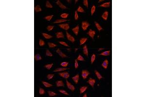 Immunofluorescence analysis of L929 cells using ST antibody (ABIN6129464, ABIN6148550, ABIN6148551 and ABIN6222848) at dilution of 1:100.