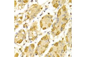 Immunohistochemistry of paraffin-embedded Human gastric using HSD17B2 antibody at dilution of 1:100 (x400 lens). (HSD17B2 anticorps  (AA 118-387))