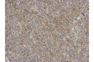 IHC-P Image Immunohistochemical analysis of paraffin-embedded Hela xenograft, using NCF1, antibody at 1:500 dilution.