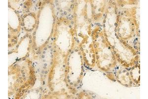 ABIN6259615 and ABIN6275472 at 1/100 staining human normal kidney tissue by IHC-P. (WTH3DI anticorps  (Internal Region))