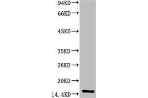 Western blot analysis of Human Serum using TTR Mouse mAb diluted at 1:2000 (TTR anticorps)