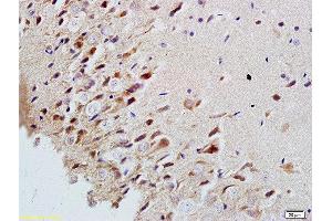 Formalin-fixed and paraffin embedded rat brain labeled with Rabbit Anti-MAP2/MAP-2a. (MAP2 anticorps  (AA 1-120))