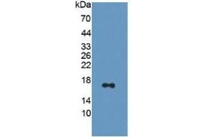 WB of Protein Standard: different control antibodies against Highly purified E. (CAP2 Kit ELISA)