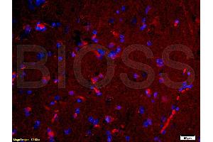 Formalin-fixed and paraffin-embedded human brain labeled with Rabbit Anti-NGAL Polyclonal Antibody, Unconjugated (ABIN685627) 1:200 followed by conjugation to the PE secondary antibody and DAPI staining (Lipocalin 2 anticorps  (AA 101-198))