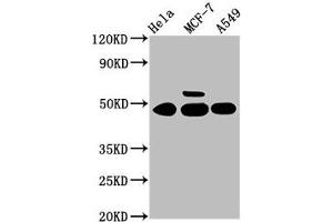 Western Blot Positive WB detected in: Hela whole cell lysate, MCF-7 whole cell lysate, A549 whole cell lysate All lanes: CSNK1G1 antibody at 3. (CSNK1G1 anticorps  (Isoform gamma 1))