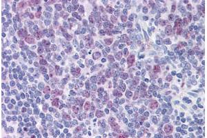 Human Tonsil: Formalin-Fixed, Paraffin-Embedded (FFPE) (HDAC4 anticorps  (AA 551-648))