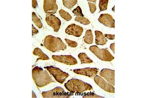 Formalin-fixed and paraffin-embedded human skeletal muscle with CDKN1B (phospho S10) polyclonal antibody , which was peroxidase-conjugated to the secondary antibody, followed by DAB staining. (CDKN1B anticorps  (pSer10))