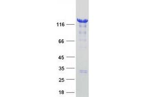 Validation with Western Blot
