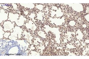 Immunohistochemical analysis of paraffin-embedded mouse lung tissue. (PERK anticorps  (pThr981))