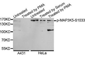 Western Blotting (WB) image for anti-Mitogen-Activated Protein Kinase Kinase Kinase 5 (MAP3K5) (pSer1033) antibody (ABIN3019485) (ASK1 anticorps  (pSer1033))