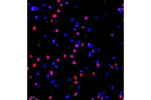 Immunofluorescence of paraffin embedded rat brain using MED17 (ABIN7074579) at dilution of 1:1500 (200x lens) (MED17 anticorps)