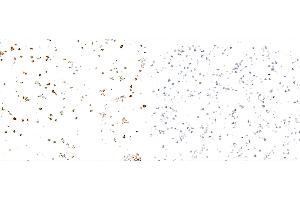 Immunocytochemistry (ICC) image for anti-Interferon gamma (IFNG) (AA 23-166) antibody (ABIN7795707)