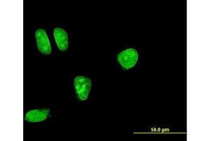 Image no. 2 for anti-Mitogen-Activated Protein Kinase Kinase 7 (MAP2K7) (AA 1-100) antibody (ABIN598899) (MAP2K7 anticorps  (AA 1-100))