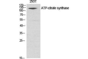 Western Blot (WB) analysis of specific cells using ATP-citrate synthase Polyclonal Antibody. (ACLY anticorps  (Ser1227))