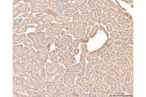 IHC analysis of BHMT using anti-BHMT antibody (ABIN7599940). (BHMT anticorps  (AA 13-386))