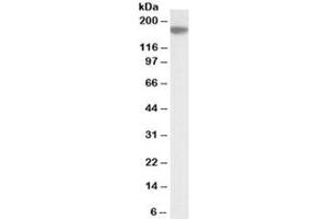 Western blot testing of A549 lysate with EVI1 antibody at 2ug/ml. (MECOM anticorps)