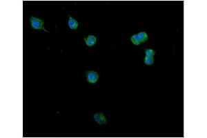 IF analysis of Clathrin heavy chain/CLTC using anti-Clathrin heavy chain/CLTC antibody (ABIN7602704). (Clathrin Heavy Chain (CLTC) (AA 967-1668) anticorps)