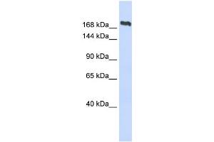 WB Suggested Anti-SMC2 Antibody Titration:  0. (SMC2 anticorps  (Middle Region))