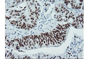 Image no. 3 for anti-Tumor Protein P53 (TP53) antibody (ABIN1499973) (p53 anticorps)