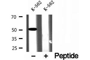 Western blot analysis of extracts of K-562 cells, using ZnT6 antibody. (SLC30A6 anticorps  (Internal Region))