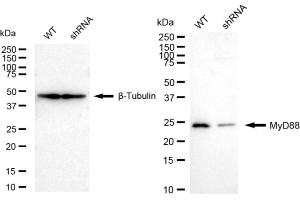 Western blotting analysis using MyD88 antibody (ABIN7799510). (Recombinant MYD88 anticorps)