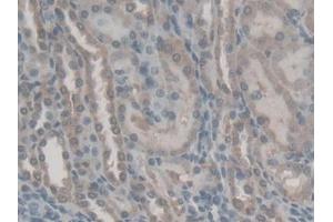 DAB staining on IHC-P; Samples: Rat Kidney Tissue