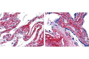 anti collagen V antibody (600-401-107 Lot 22063, 1:200, 45 min RT) showed strong staining in FFPE sections of human lung (left) with strong staining within alveoli, vessels, and in connective tissue spaces; and placenta (right) with strong staining observed in stromal and connective tissue spaces and vessel walls. (Collagen Type V anticorps)